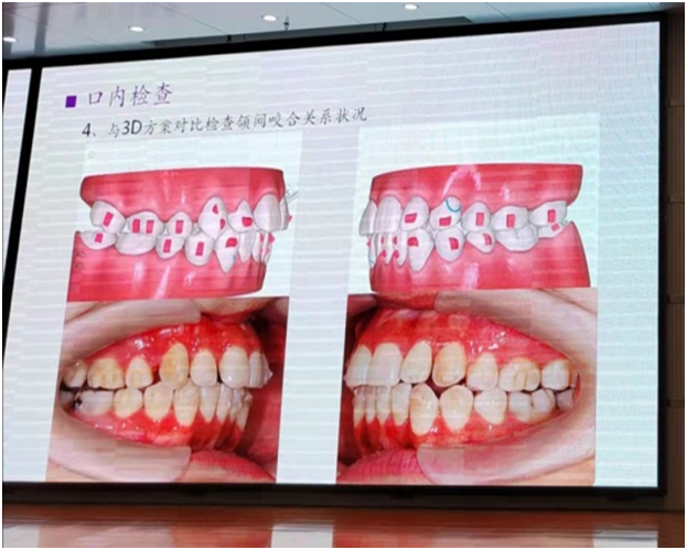 必赢bwin线路检测开展牙齿隐形矫治临床诊疗技术培训(图3)