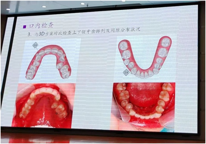 必赢bwin线路检测开展牙齿隐形矫治临床诊疗技术培训(图5)