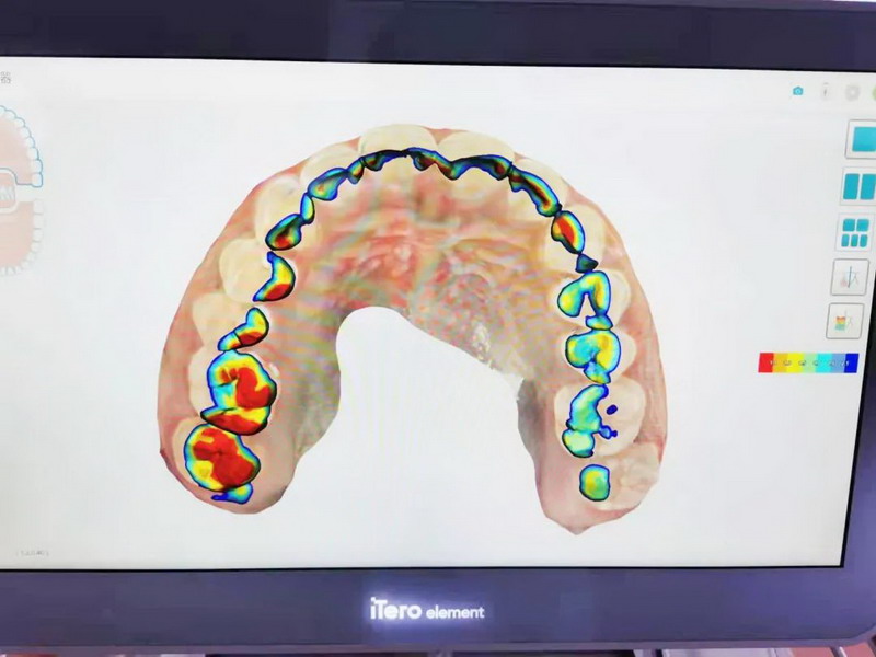 数字化口腔 | 引领口腔正畸诊疗新未来(图2)