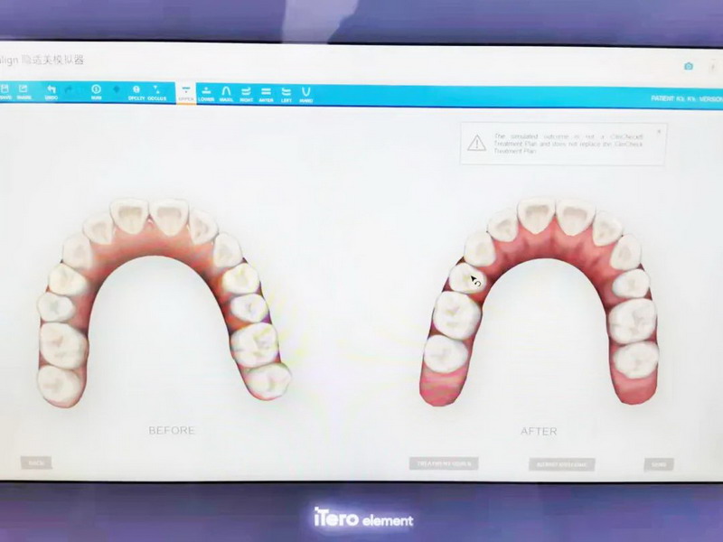 数字化口腔 | 引领口腔正畸诊疗新未来(图4)